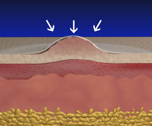 Skin Patch 2x1 a 49,99€