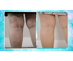 Veins Gone 2x1 a 59,99€